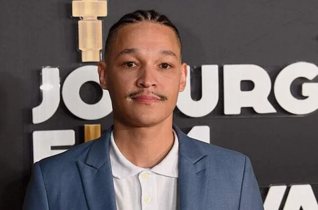 Brighton Ngoma Reveals How Vitiligo, Fame and Trauma Shaped His Acting
