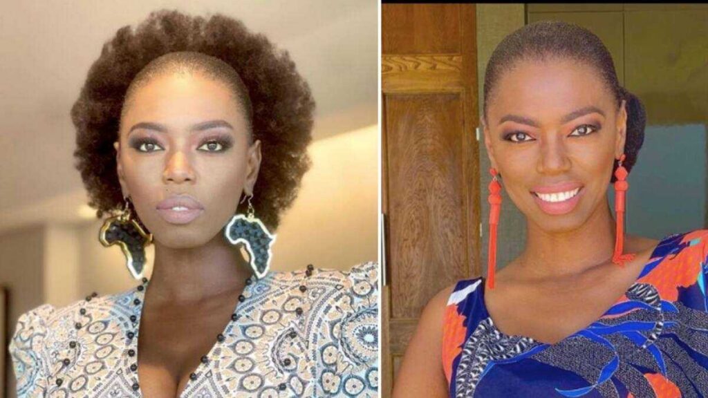 “I Broke Down” Lira On How She Suffered A Stroke While Walking Alone In Germany