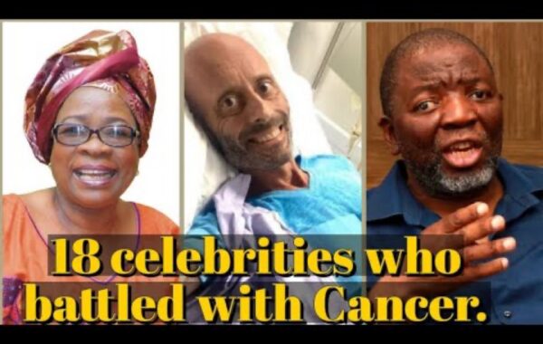 South African celebs diagnosed with cancer