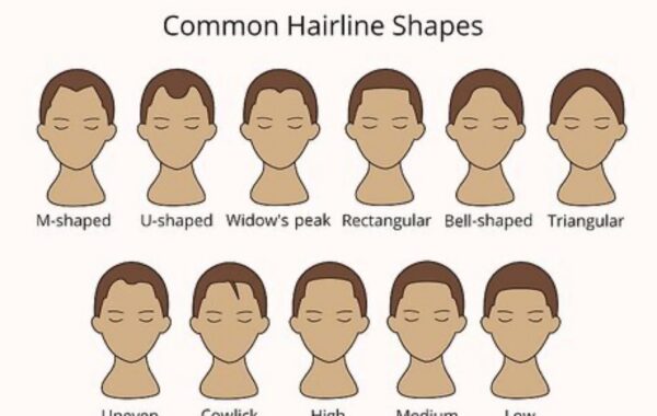 Hairlines that have survived the entertainment industry