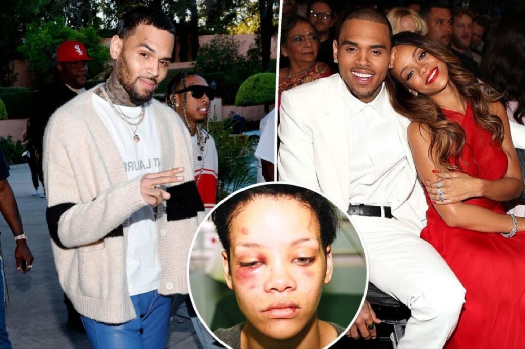 Chris Brown ‘hurt’ by Rihanna attack
