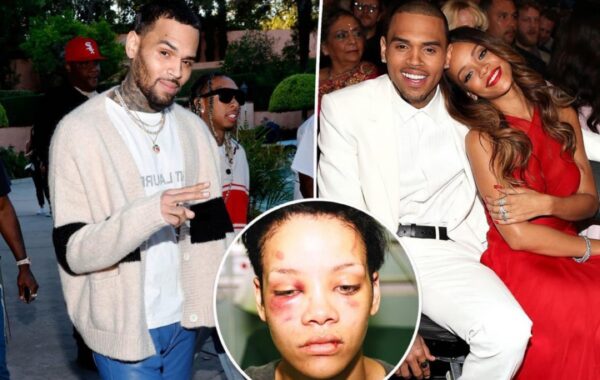 Chris Brown ‘hurt’ by Rihanna attack