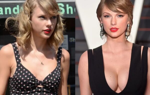 Taylor Swift Gets Breast Implants?