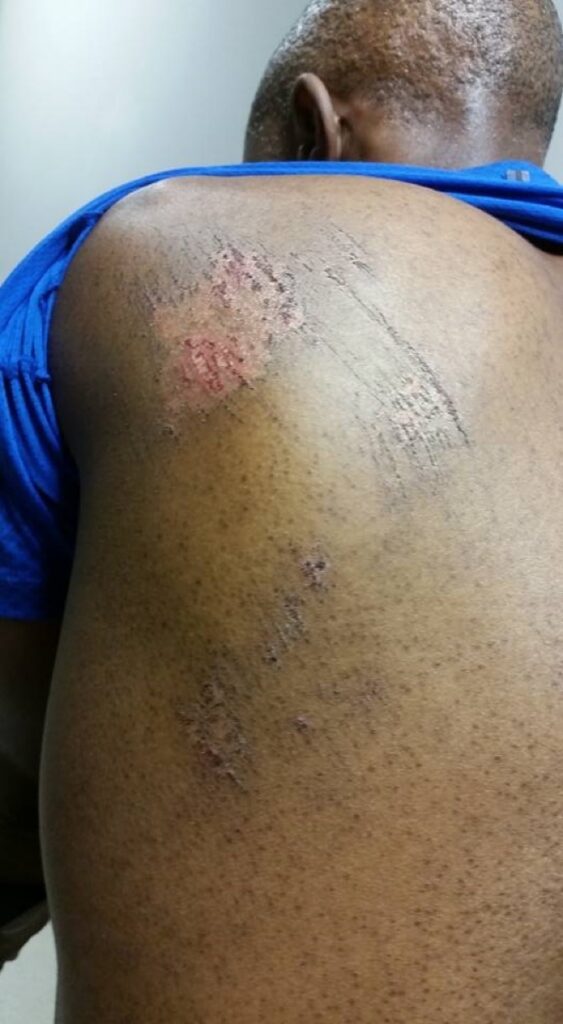 What’s Hot: Thapelo Mokoena survives hit and run