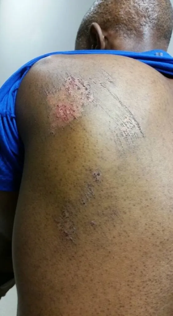 What’s Hot: Thapelo Mokoena survives hit and run