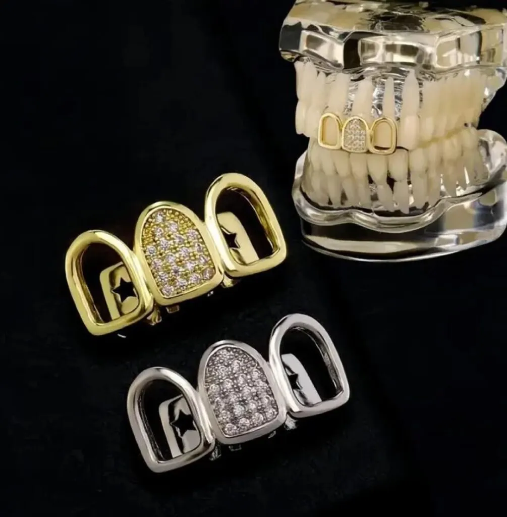 #OPW: Silver tooth matches wedding bling