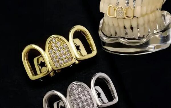 #OPW: Silver tooth matches wedding bling
