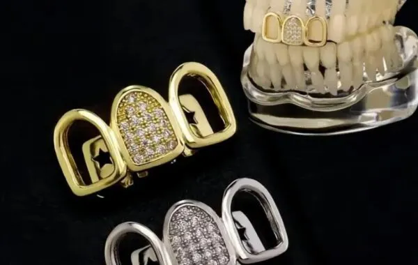 #OPW: Silver tooth matches wedding bling