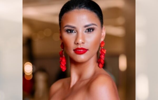 Former Miss SA’s Baby Has Gone Blind