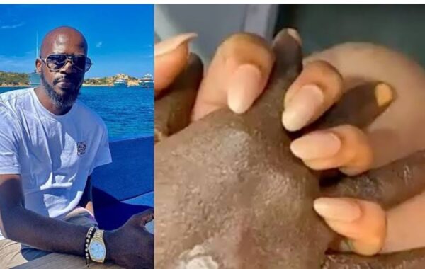What Happened To Black Coffee’s Hand?